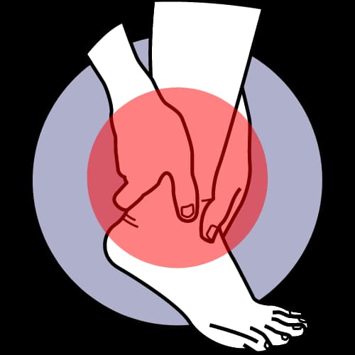 Illustratie bij Logesyndroom van de m. tibialis anterior